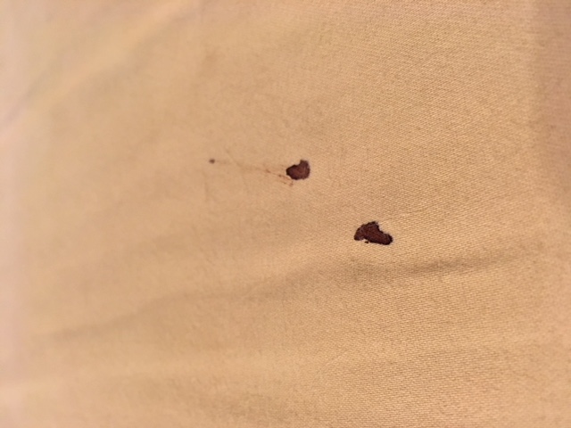 how to remove blood from sheets